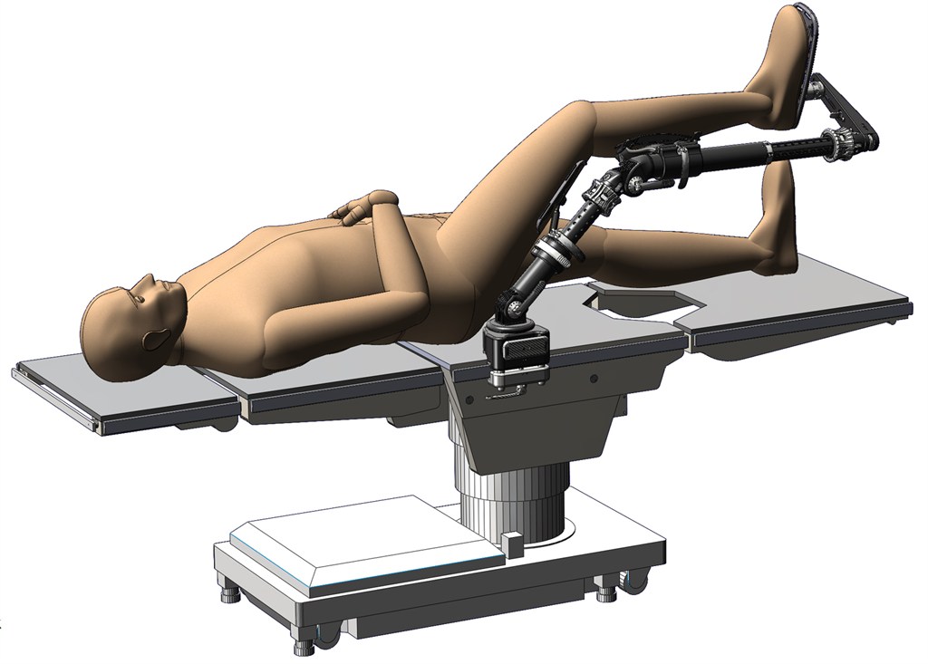 Surgical Leg Positioning System